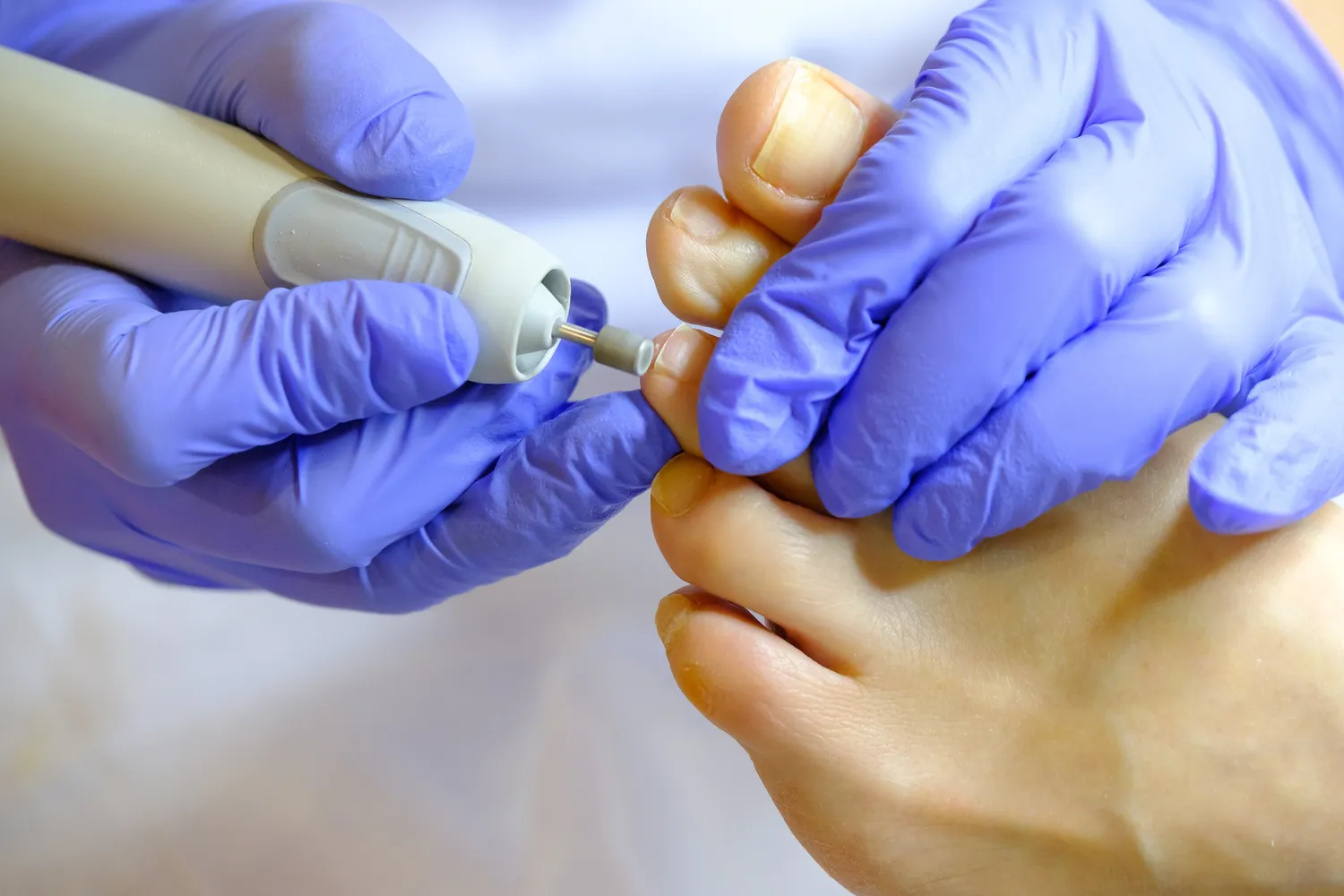 Pedicure leczniczy - co o nim wiedzieć warto?